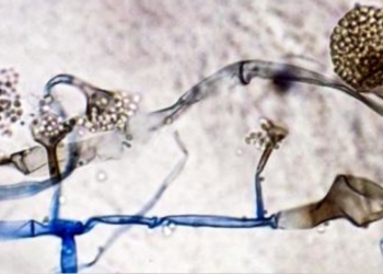 Black Fungus is not an infection that is contagious: Read details