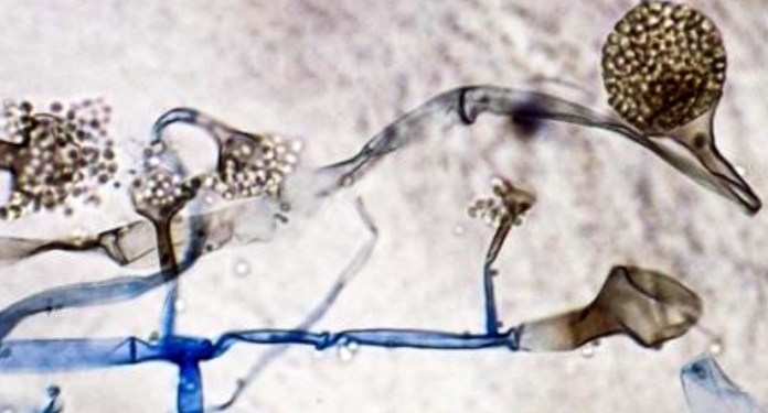 Black Fungus is not an infection that is contagious: Read details