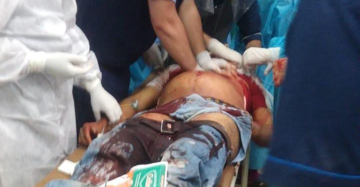 Habba Kadal Incident: Injured Youth Succumbs
