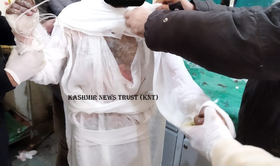 Young man attempts suicide by setting self on fire in kashmir