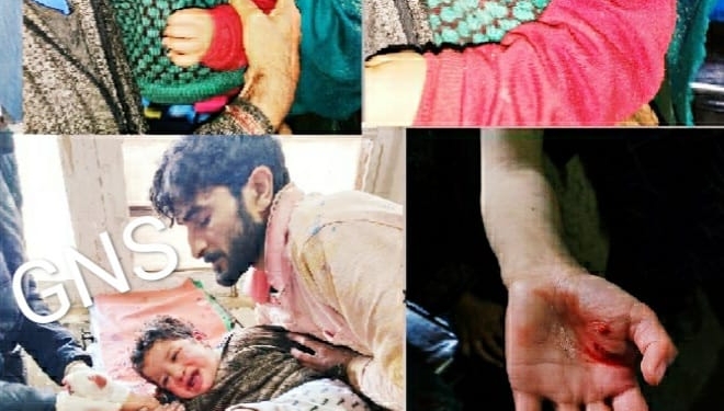 Stray Dogs Unleash Terror, Injure Nearly A Dozen,Which mainly included children in Kashmir…