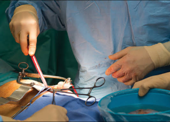 First Kidney Transplant Case performed under ABPMJAY Scheme at SKIMS&nbsp;