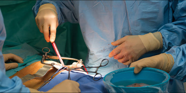 First Kidney Transplant Case performed under ABPMJAY Scheme at SKIMS