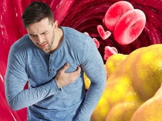 7 Herbal Drinks That Can Help Flush Out Cholesterol And Prevent Stroke