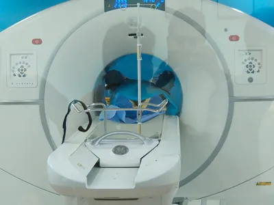 Govt notifies rates for PET scans in Govt-run hospitals