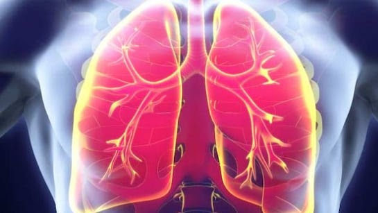 Lung Cancer Cases In Never-Smokers On The Rise: Lancet Study