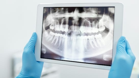 Woman Jumps Off Hospital Roof After Doctor Messes Up Tooth Extraction