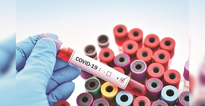 Kashmir Has Two Active COVID-19 Cases at Present; Both Casses Mild, Situation Under Control: Officials