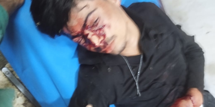 Bear Attack Leaves 16 yrs old Boy Injured in Batagund Handwara